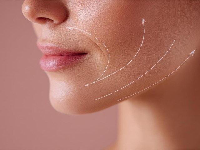 10 consejos para los cuidados después de un lifting facial