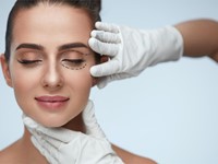 Blefaroplastia: ¡luce tu mejor mirada! 