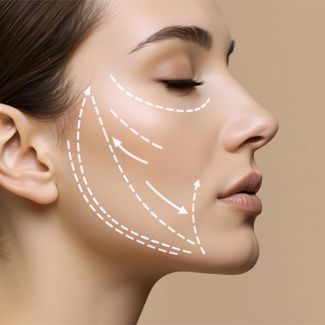 Consiga un rostro más joven con un lifting facial
