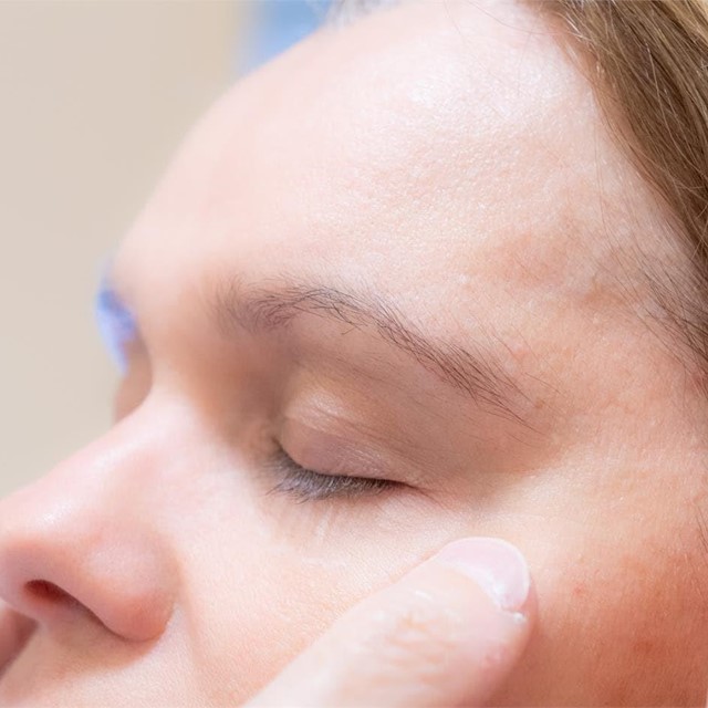¿Cuál es el tiempo de recuperación de una rinoplastia?