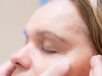 ¿Cuál es el tiempo de recuperación después de una rinoplastia?