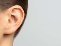 ¿Cuál es la edad ideal para una otoplastia?