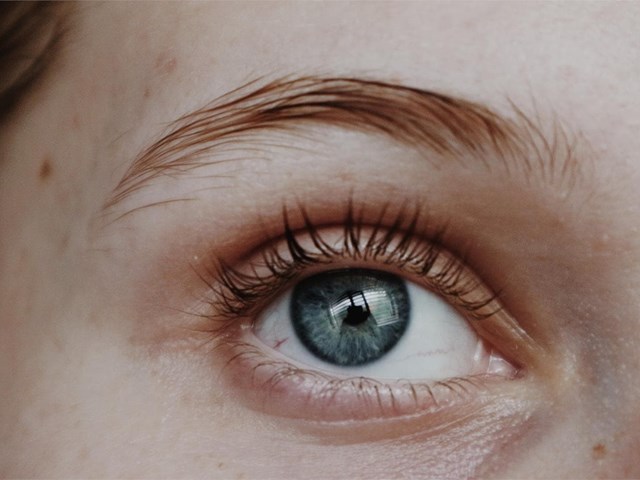 Elimine las bolsas de sus ojos gracias a la cirugía de párpados