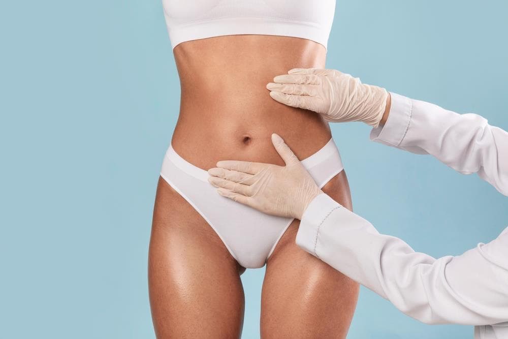 ¿En qué casos se recomienda una abdominoplastia?