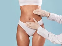 ¿En qué casos se recomienda una abdominoplastia?