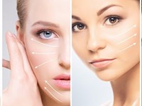 ¿Es posible combinar varios procedimientos de cirugía facial en una sola operación?