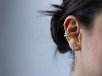 ¿La otoplastia corrige el aspecto de las orejas?