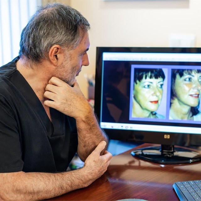 Lifting facial y blefaroplastia: combinación perfecta