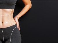 Mitos y verdades sobre la liposucción
