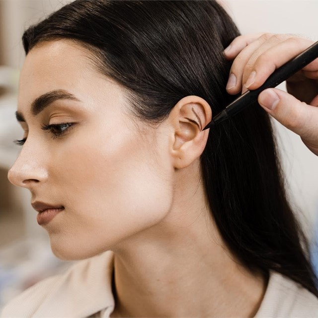 Orejas de soplillo: la otoplastia como solución