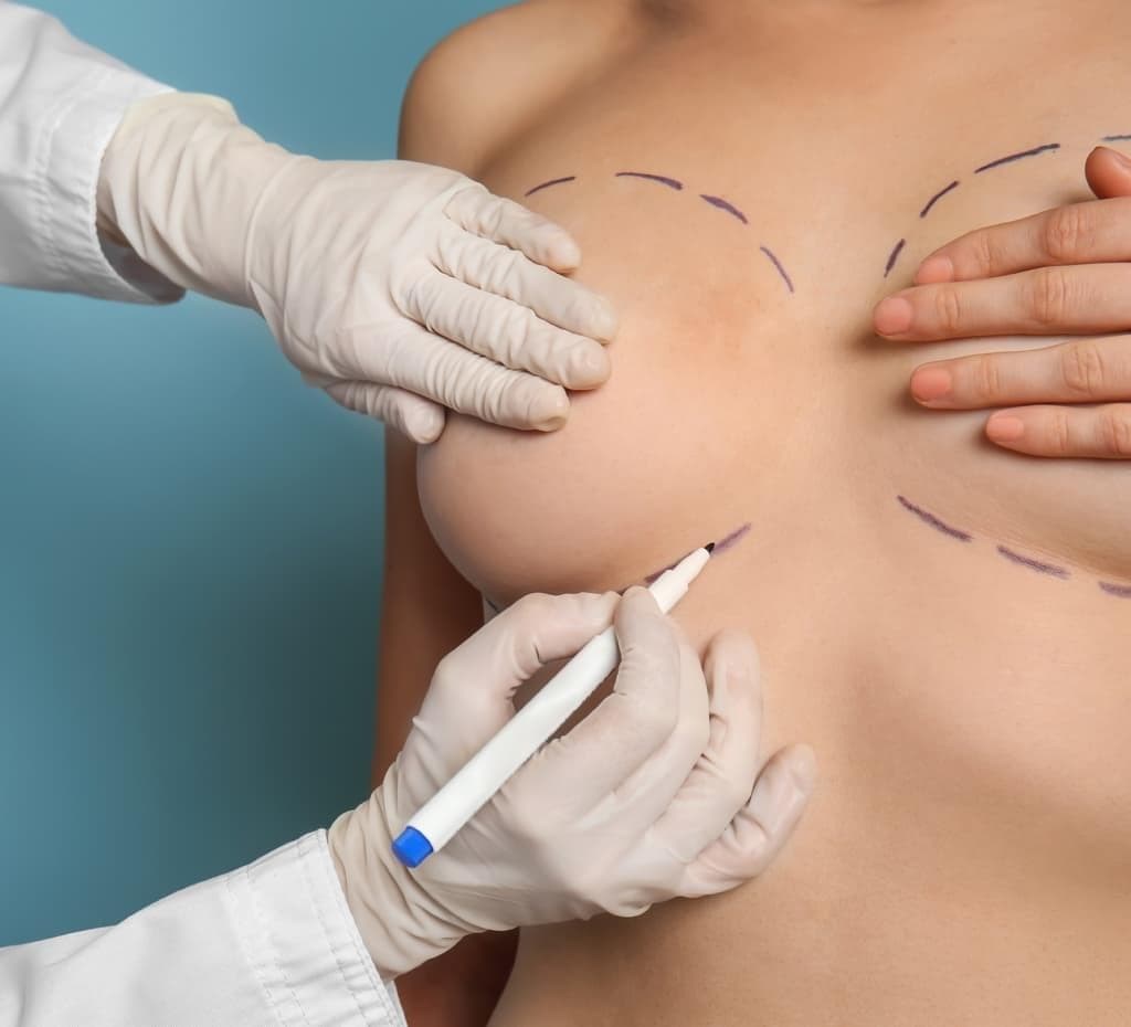 Reducción de pecho: ¿qué mujeres se someten a este tipo de cirugía?