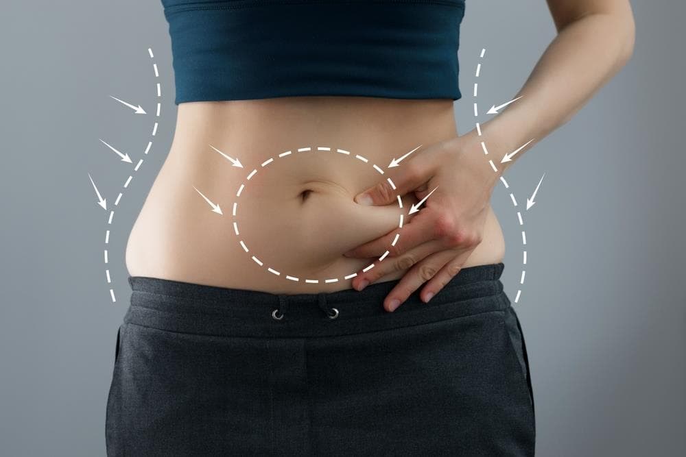 Tipos de abdominoplastia que realizamos en la Clínica Dr. J. L. Vila Moriente
