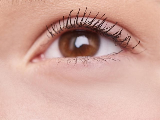 Tipos de blefaroplastia: inferior, superior y completa