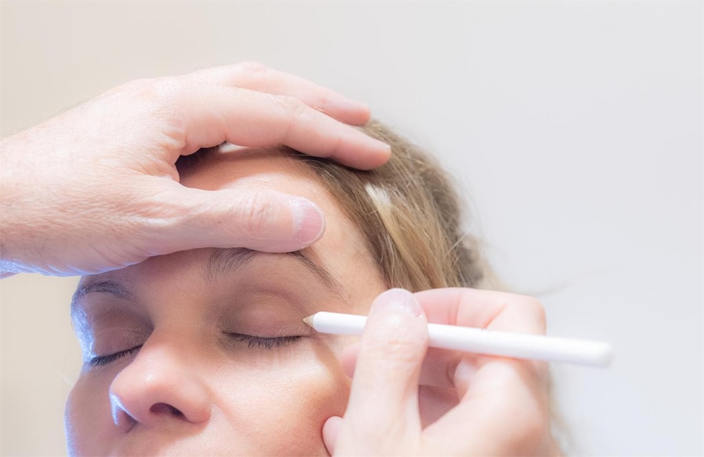 Un rostro más estilizado gracias al lifting facial