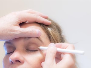 Un rostro más estilizado gracias al lifting facial